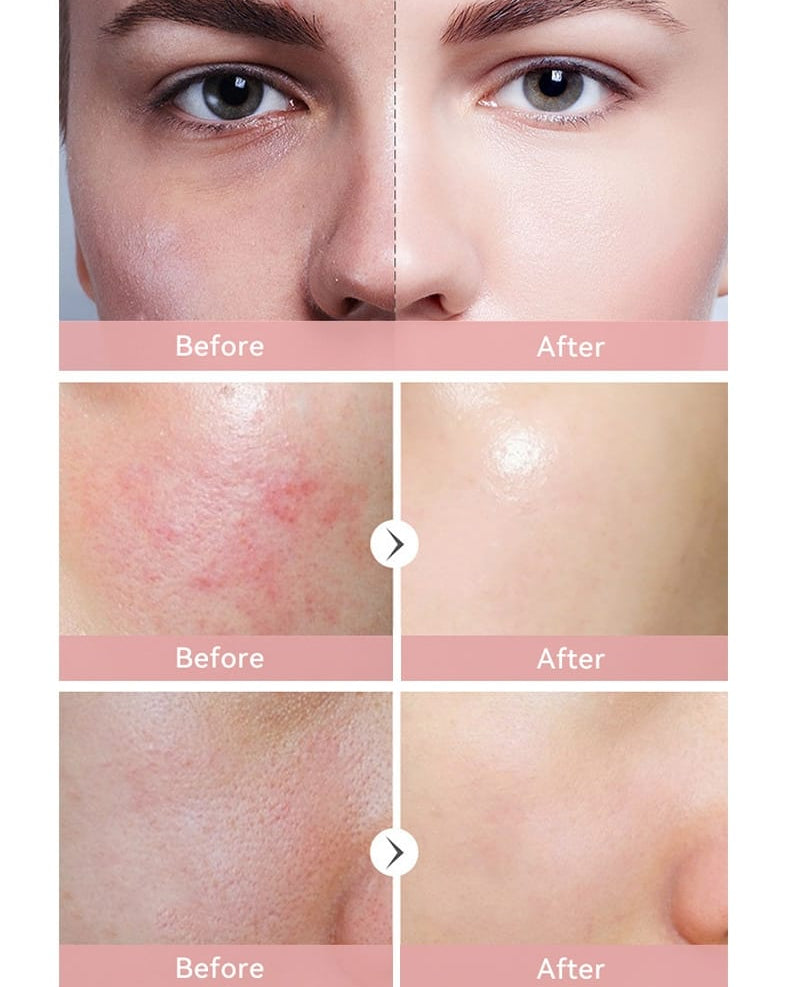 Pink Cloud Jelly Treatment Wash For Normal Skin | Quantity 100ml