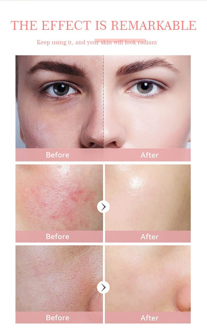 Pink Cloud Jelly Treatment Wash For Normal Skin | Quantity 100ml
